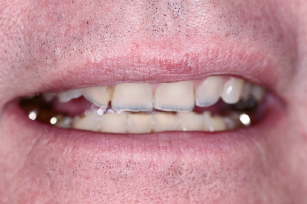 Total Care Dental Madison Total Care Dental Madison