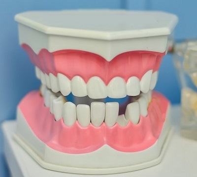 Mouth Model with Missing Teeth