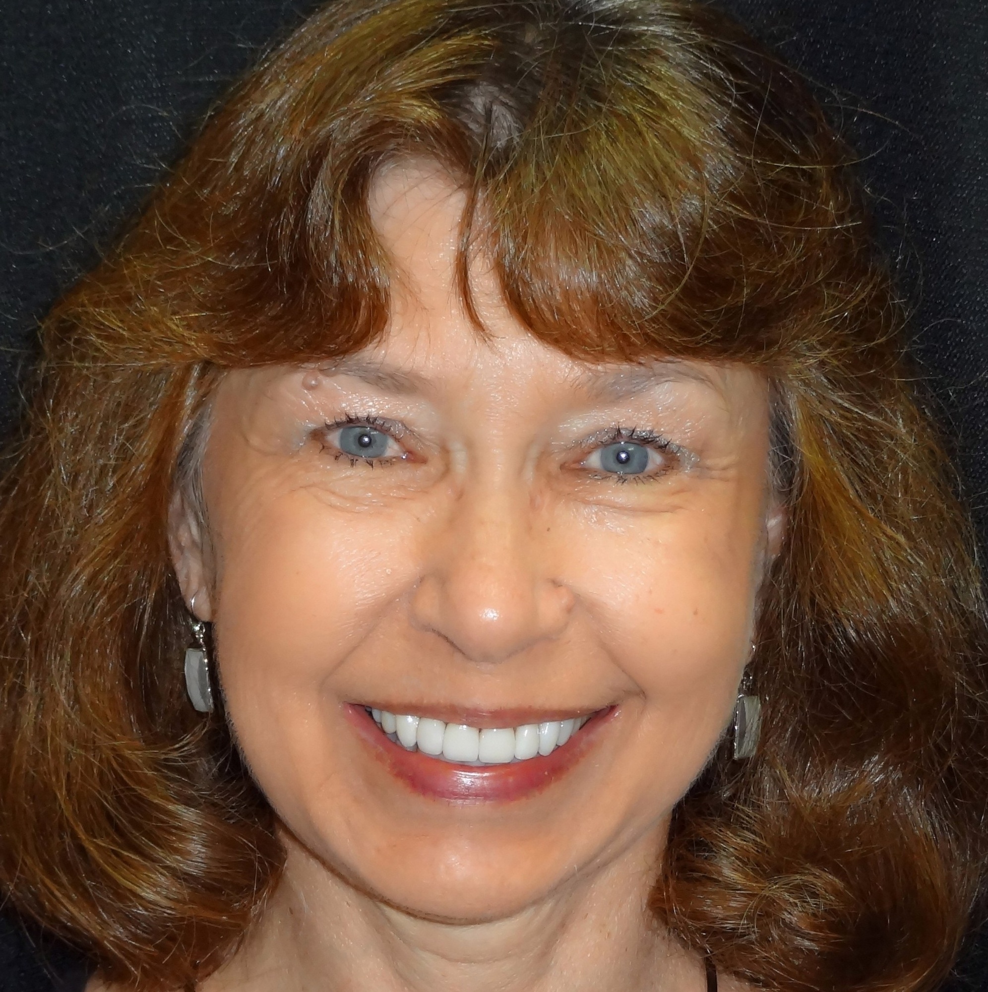Check out Barb's new smile! Barb's New Smile