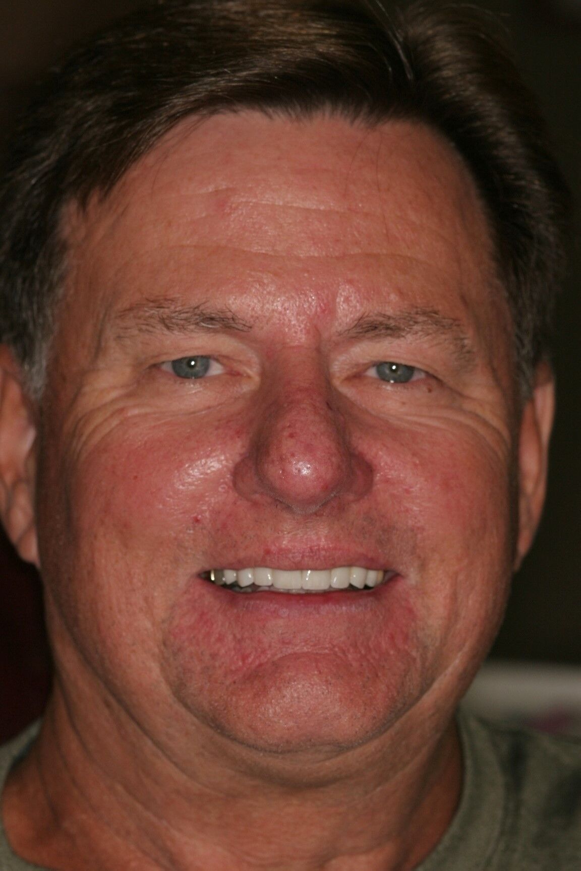 Michael Before - Join Michael on his smile makeover journey with this candid "before" snapshot.
