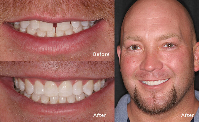 JT's smile evolution: From reserved to confidently dazzling!