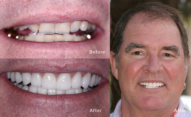 Steve's smile tale: Before, modest; now, boldly brilliant!