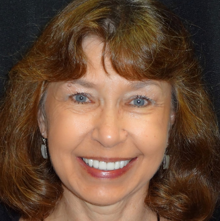 Check out Barb's new smile! Barb's New Smile