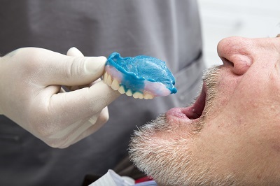 Creating New Dentures