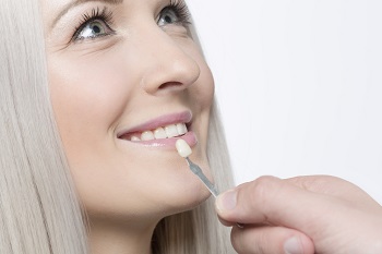 Woman with Veneers