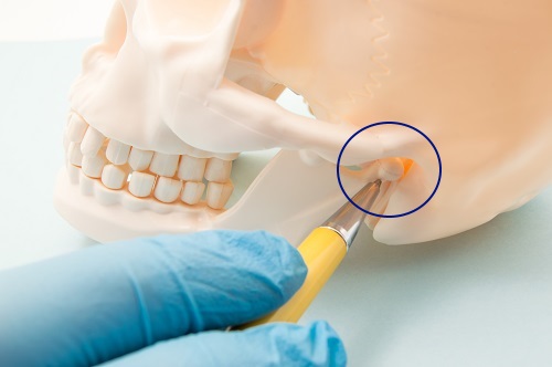 TMJ Joint Causes Dental problems
