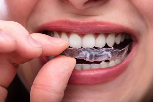 Invisalign available with no insurance at Total Care Dental