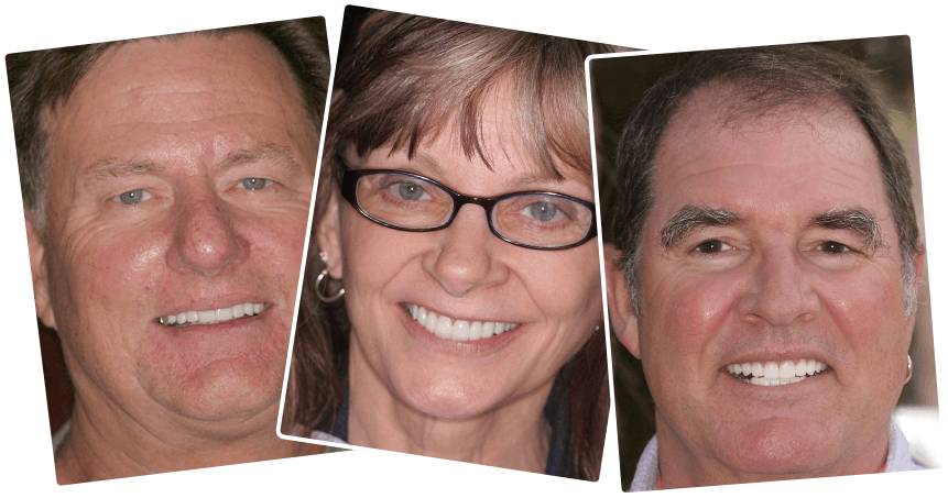 No insurance dental work results