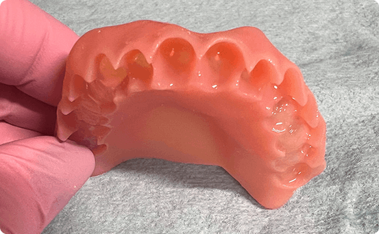 Dentures step 1