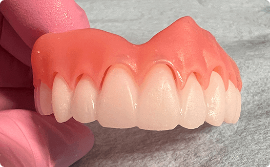 Dentures step 3
