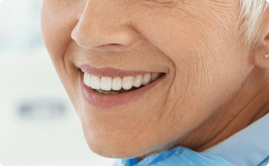 Invisalign before & after 1