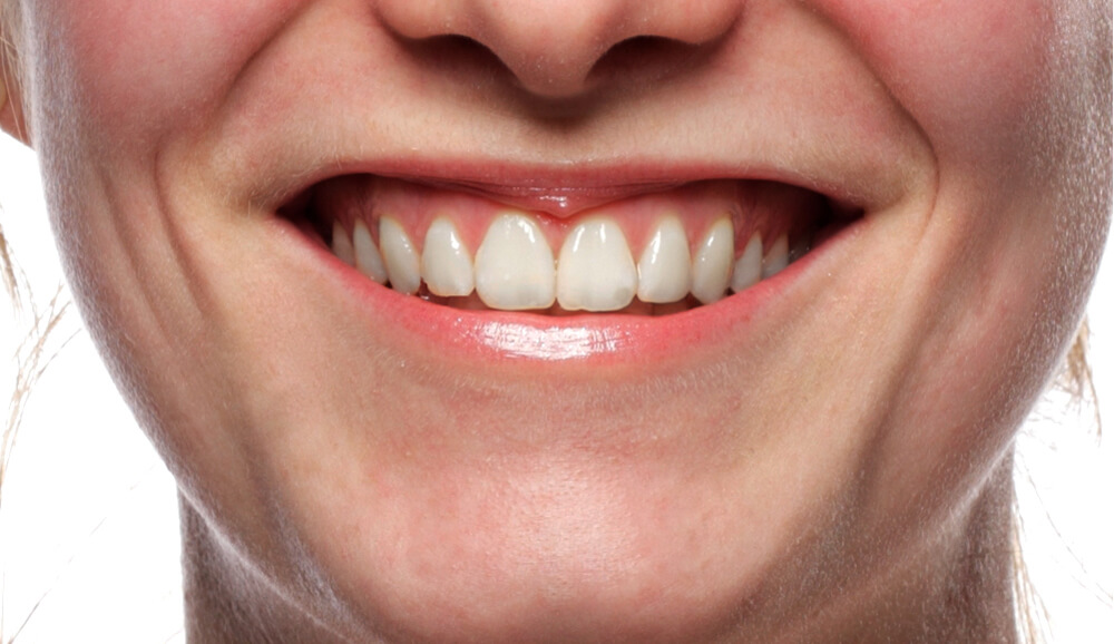 Bright and shining smile with dentistry that fits your needs