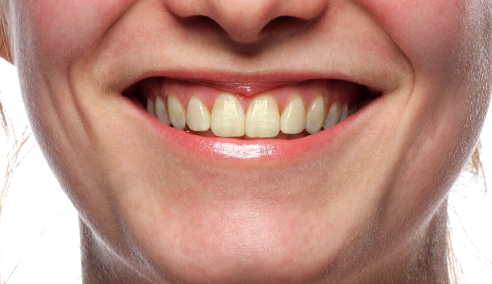 Are you ready for a brighter smile?